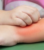 Ghid de la dermatolog: cum recunoști bolile de piele ale copilului