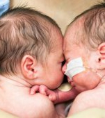 Ține-l în viață: Povestea celor doi frați care au fost salvați, pentru că s-au născut în maternitatea potrivită