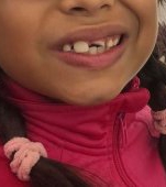 Fetița unei vedete de la noi, discriminată de colegi. „I-au spart un dinte: O să fac plângere la Ministru”