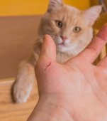 Boala zgârieturii de pisică: simptome și tratament