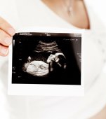 O fetiță s-a născut gravidă și a fost necesară o operație de cezariană chiar în a doua zi de viață