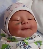 Îngrozitor! Un nou-născut s-a ales pe viață cu o cicatrice, după ce medicii i-au tăiat obrazul în timpul cezarienei