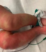 Copiii bolnavi de coronavirus pot face această boală rară? Primul semn că există o legătură între cele două afecțiuni dezvăluit de medici, cu imagini clare