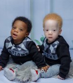 A născut doi copii complet diferiți, dar sunt gemeni identici! Cum este posibil?