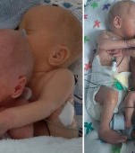 Imaginea care a înduioșat internetul. Doi bebeluși gemeni născuți prematur se îmbrățișează când sunt puși în același incubator