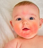 Pete roșii pe piele la copii: de ce apar și cum le tratezi