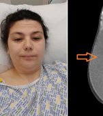 Medicii i-au spus că e doar surplus de grăsime, dar această mamă era să moară din cauza unei boli nediagnosticate!