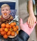 Un copil a ajuns de urgență la spital, cu pielea galbenă, după ce a mâncat prea multe portocale. Ce diagnostic a primit