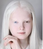 Are 11 ani, suferă de albinism și este una dintre cele mai frumoase fetițe din lume!