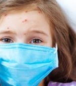 Este oficial! A fost declarată epidemie de rujeolă în România