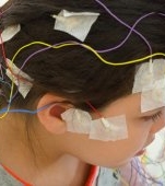 Epilepsia, una dintre cele mai frecvente boli neurologice la copii. Care sunt semnele
