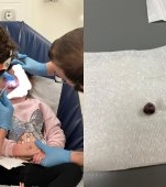 Mare grijă la obiectele mici, când vine vorba despre copii. O fetiță a fost bolnavă timp de 3 luni de la o stafidă blocată în nas