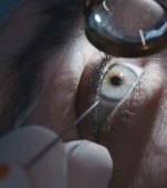 Chist dermoid orbital: cauze, simptome și tratament