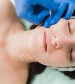 Lifting cu fire bioresorbabile: recomandări și recuperare