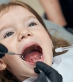 Dinți suprapuși sau înghesuiți la copii - ce înseamnă și cum se corectează?