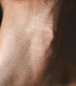 Semnul Kussmaul: cauze, simptome și tratament