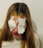 O mamă trage un semnal de alarmă pentru părinții de fete adolescente după ce fiica ei a ajuns cu corneea arsă. „Aruncați toate cutiile cu gene false"