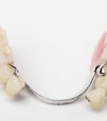 Cum sa alegi bontul protetic potrivit pentru fiecare caz? X sfaturi si recomandari