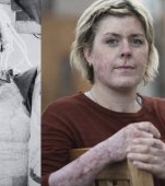 A trecut prin foc, la propriu, pentru a-și salva familia! Mama care a supraviețuit miraculos cu 93% arsuri pe corp după ce și-a salvat cei 6 copii dintr-un incendiu