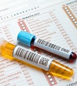 Ionograma serică: ce este și când este recomandată