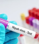 Virusul Nipah: cauze, simptome și tratament