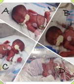 Astepta tripleti, insa a nascut cvadrupleti identici