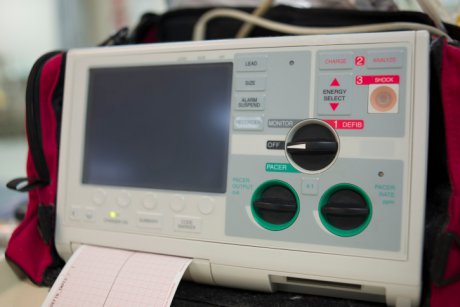 Totul despre electrocardiograma