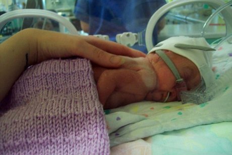 Bebelusii nascuti prematur la 23 de saptamani pot fi acum salvati