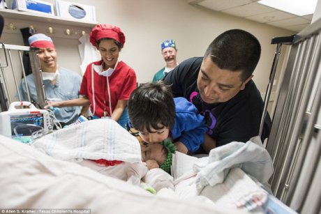 Operatie de separare a doua fetite siameze la un spital american 