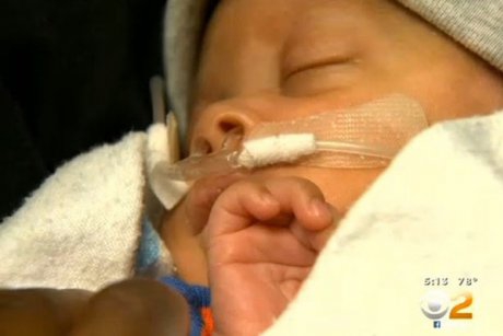Bebelusul-miracol: S-a nascut cu tot cu sacul amniotic