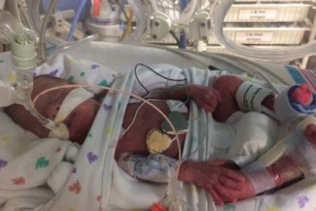 Un bebelus nascut la 23 de saptamani pe un vas de croaziera supravietuieste, dar se pun probleme legate de asa-numita "luna de miere" a bebelusilor