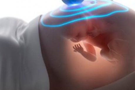 Va putea tehnologia de imprimare 3D sa inlocuiasca investigatiile cu ultrasunete din timpul sarcinii?