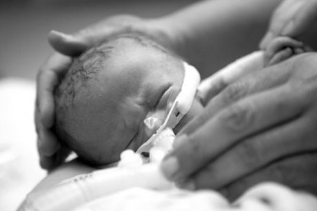 Fotografii emoţionante care spun povestea vieții scurte a unei bebelușe
