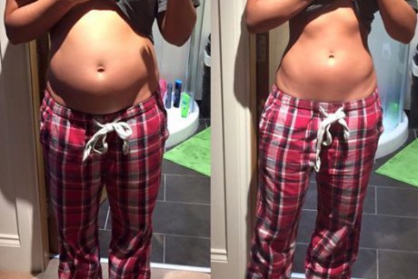 O bloggeriță de fitness postează o poză reală: Nu sunt însărcinată, sunt doar balonată