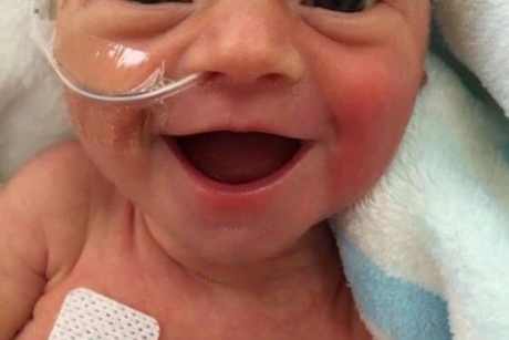 Zâmbetul uimitor al unui bebeluș prematur la numai 5 zile de la naștere