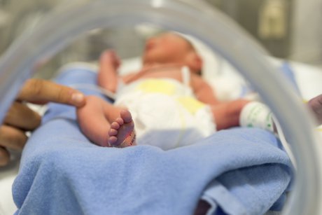 Doar 8 cazuri in lume: bebeluşul născut fără faţă la maternitatea din Botoşani