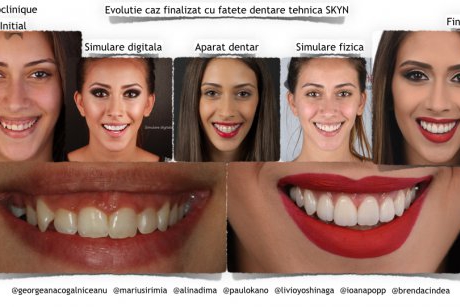 Estetică dentară în timp real, inovație stomatologică la Neoclinique