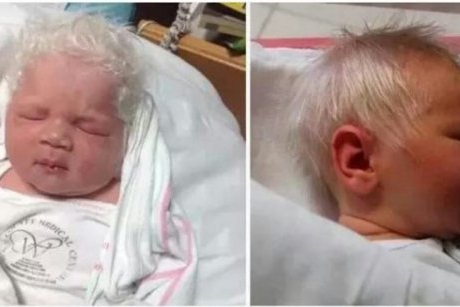 Bebelușul născut cu părul în totalitate alb