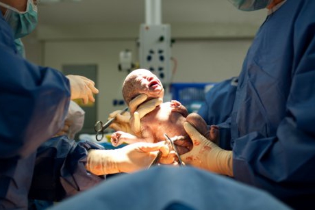 13 situații în care nașterea prin cezariană este obligatorie 