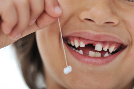 Ce poți face cu celulele stem din dinții de lapte ai copiilor 