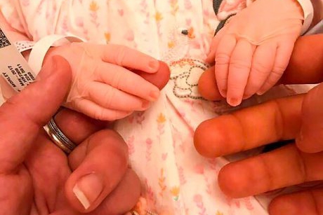 Fotografia emoționantă a bebelușei născută moartă pentru că a fost otrăvită în uterul mamei