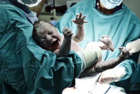 Fotografii necenzurate de la naștere care îți vor tăia respirația