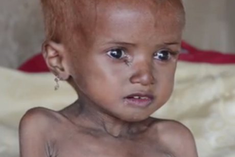 Holeră și foamete în Yemen! Copiii mor pe capete, mamele plâng!