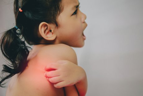 Cum recunoști insecta care ți-a mușcat copilul în funcție de ciupitură