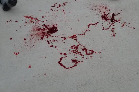 O mamă dezvăluie poze cu băiatul ei plin de sânge după ce a fost brutalizat de colegii de la școală
