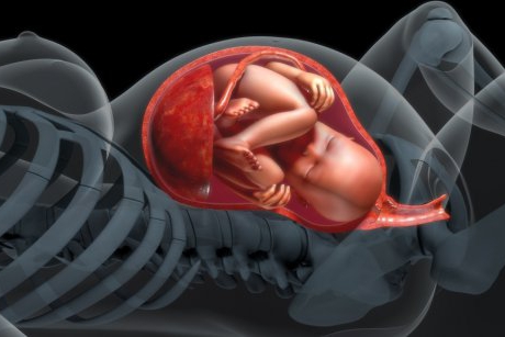 Placenta accreta: cauze și simptome