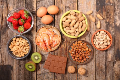 12 alimente cu proprietati antiinflamatorii