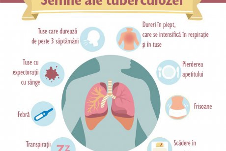 Semne că ai putea să ai tuberculoză