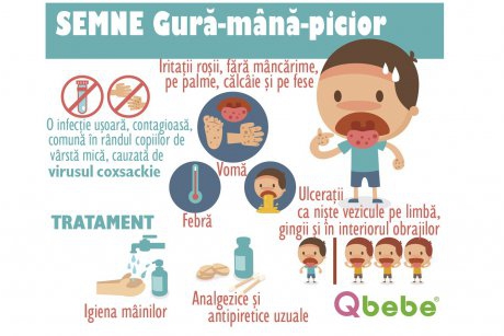 Gură-mână-picior: semne că al tău copil are această boală a copilăriei