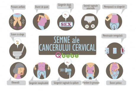 9 semne care îți spun că s-ar putea să ai cancer cervical